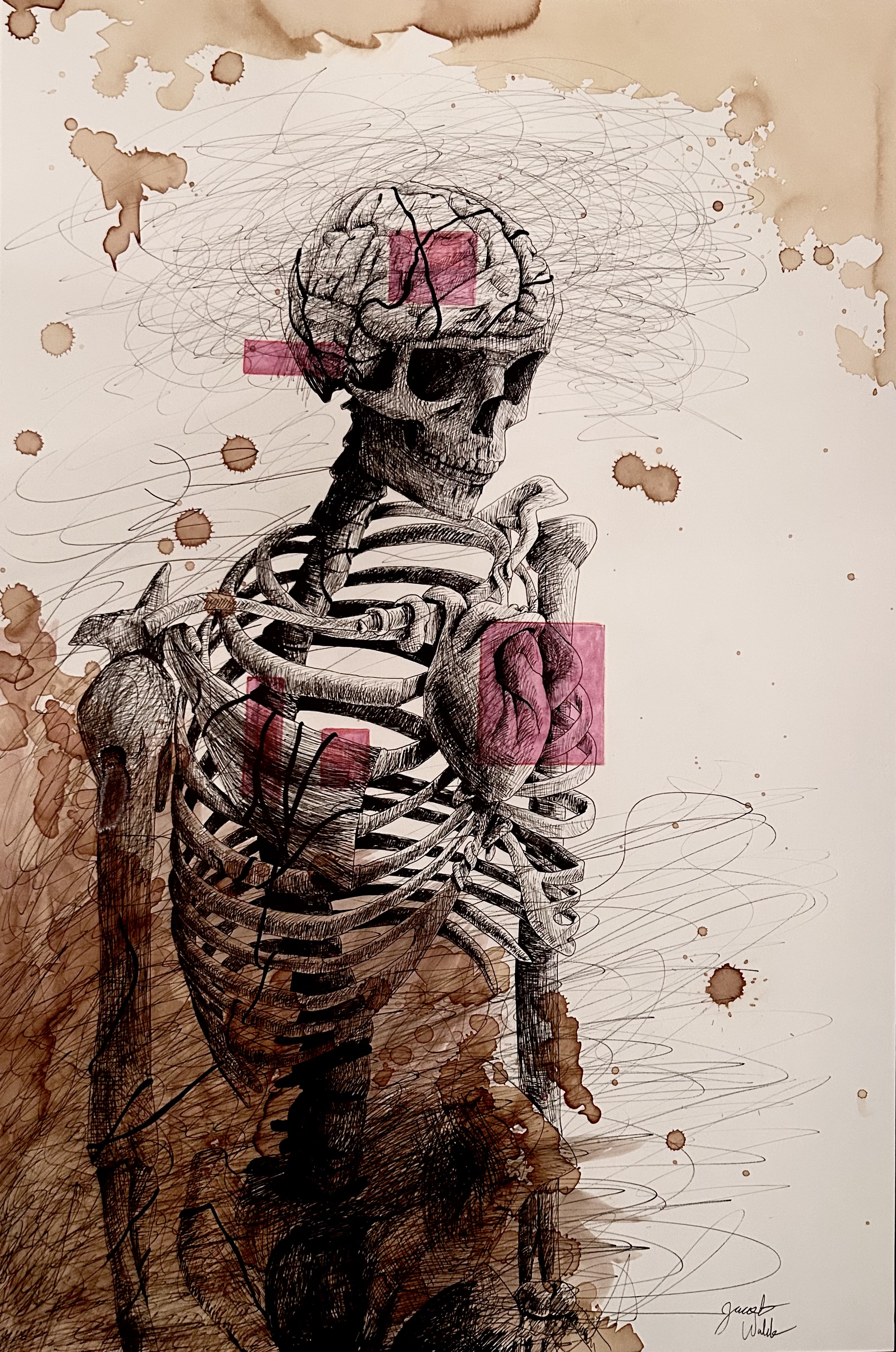 The Body's Response to Chronic Anxiety and Stress